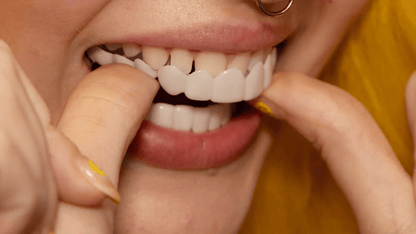 Carillas Dentales Instantáneas Reutilizables