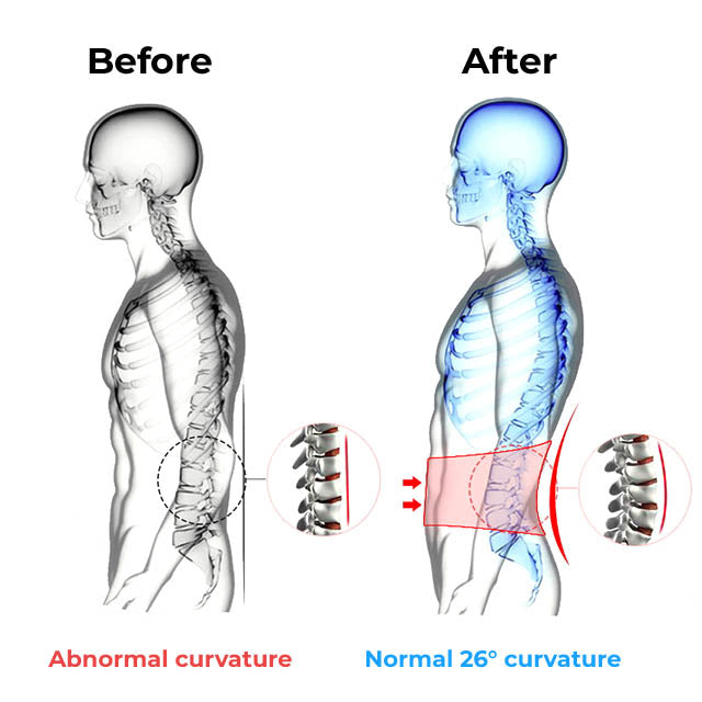 Faja Lumbar Ortopédica con Doble Ajuste – Soporte para Espalda Baja